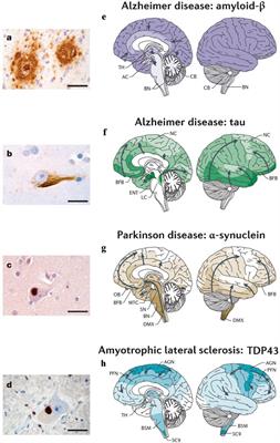 Mathematical Modeling of Protein Misfolding Mechanisms in Neurological Diseases: A Historical Overview